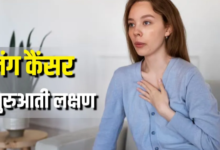 Photo of मामूली लगने वाली ये छोटी-छोटी परेशानियां करती हैं Lung Cancer का इशारा