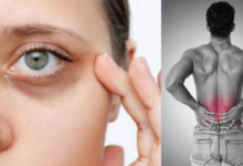 Photo of शरीर में दिखें ये 7 लक्षण तो समझ जाएं कम हो गया है Collagen