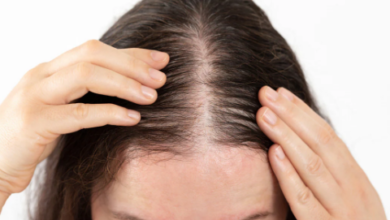 Photo of हेयर फॉल की सबसे बड़ी वजह है प्रोटीन की कमी