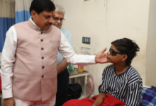 Photo of हमीदिया अस्पताल पहुँचे सीएम यादव: कार्बाइड गन से घायल बच्चों से मिले