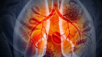 Photo of फेफड़ों के कैंसर के खिलाफ बड़ी कामयाबी
