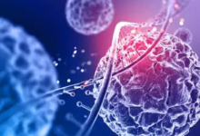 Photo of कैंसर के शुरुआत में नजर आते हैं ये 5 लक्षण