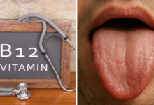 Photo of जीभ पर दिखते हैं विटामिन-B12 की कमी के 3 बड़े संकेत