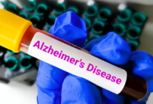 Photo of लक्षण दिखने से 10 साल पहले ही पता चल सकेगा अल्जाइमर का खतरा