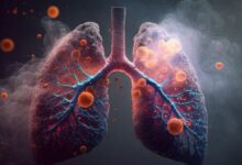 Photo of फेफड़ों से जुड़े ये चार लक्षण भूलकर भी न करें नजरअंदाज