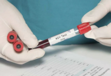 Photo of विश्व एड्स दिवस पर दूर करें इस बीमारी से जुड़ी 3 मिथक