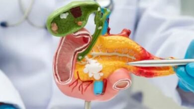 Photo of क्यों नहीं पहचान आते पैंक्रियाटिक कैंसर के लक्षण? जाने