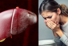 Photo of त्वचा पर नजर आते हैं लिवर की खराबी के 5 लक्षण