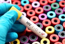 Photo of  दिल्ली में एचआईवी के 60 हजार मरीज, राष्ट्रीय औसत से अधिक है राजधानी में प्रसार दर