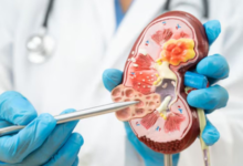 Photo of किडनी खराब होने से पहले आंखें देती हैं 6 संकेत, सुबह उठते ही जरूर करें चेक