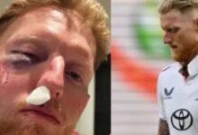 Photo of इंग्लैंड के कप्तान बेन स्टोक्स के चेहरे पर लगी भयानक चोट