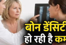 Photo of डाइट और एक्सरसाइज का ये कॉम्बिनेशन बढ़ा देगा बोन डेंसिटी